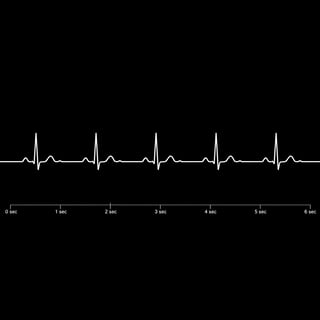 White Monochrome EKG Vector on Black